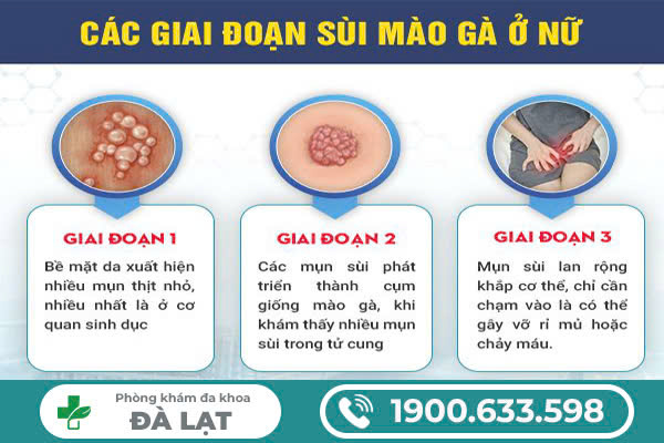 Hình ảnh minh họa